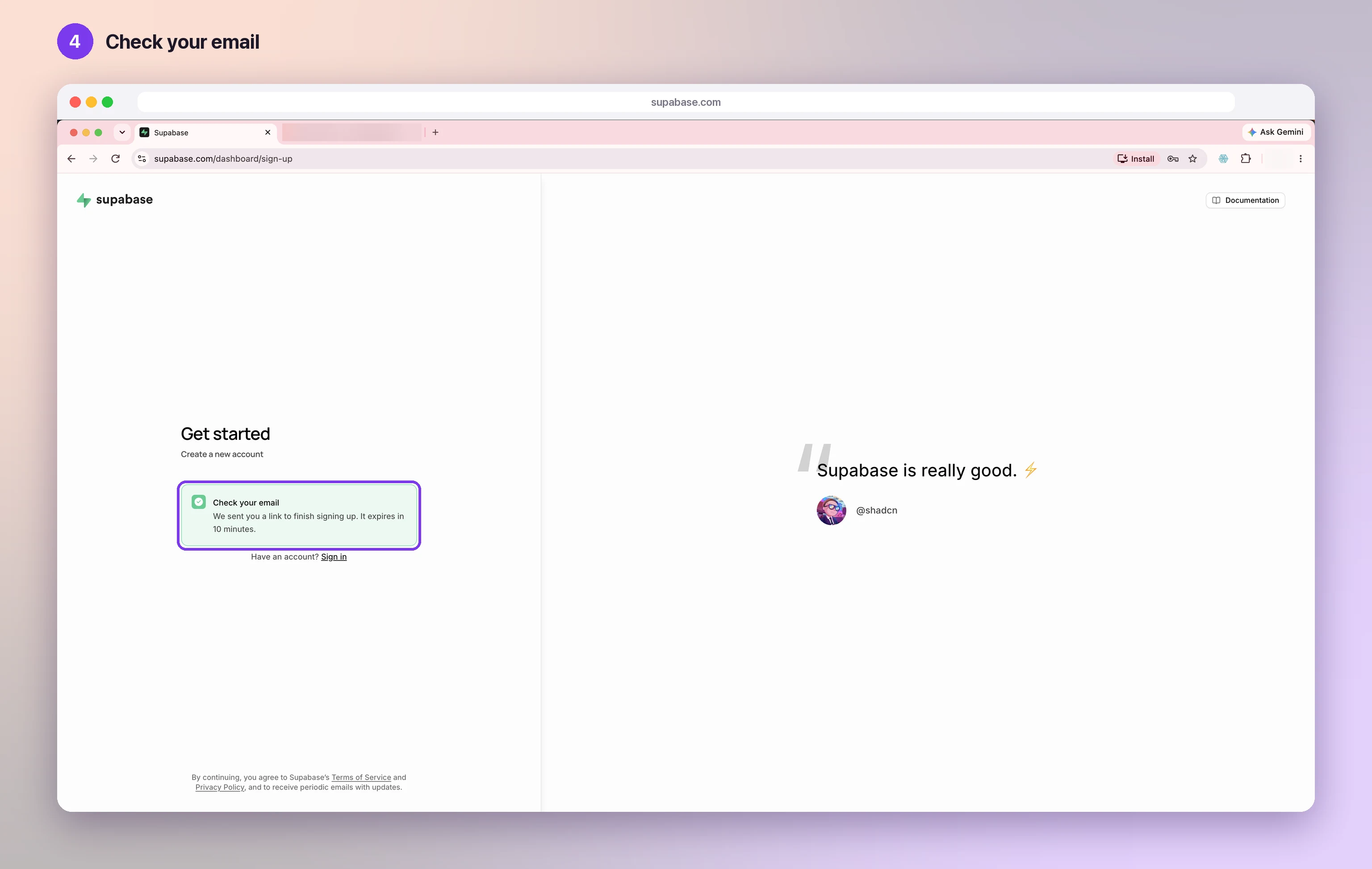 The Supabase page saying Check your email, highlighted, after pressing Sign up